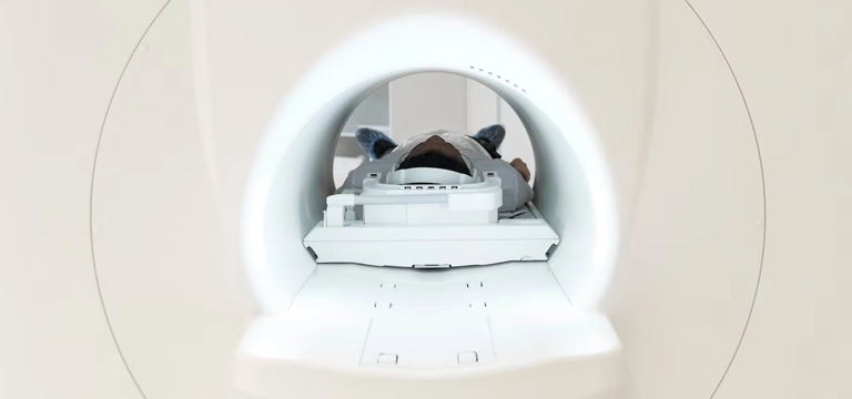 Unveiling 3 Tesla MRI Scan; Everything a Patient Should Know